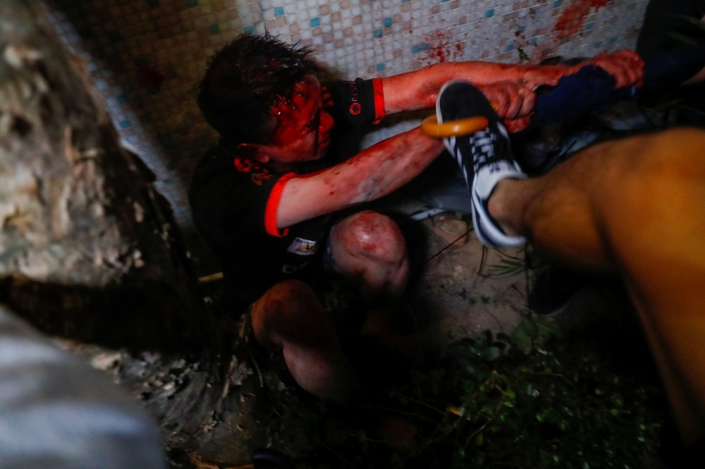 Hong Kong vive una nueva noche de violencia y luto